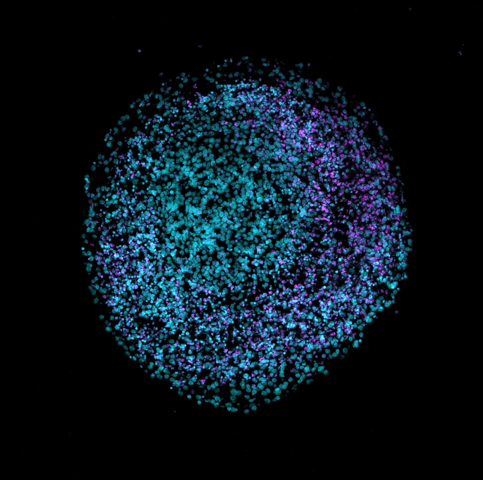 Human_Brain_Organoid